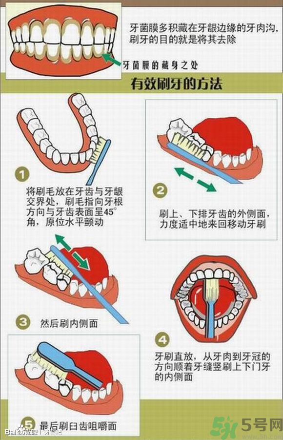 18歲還能戴牙套嗎？戴牙套真的能瘦臉改變臉型嗎？