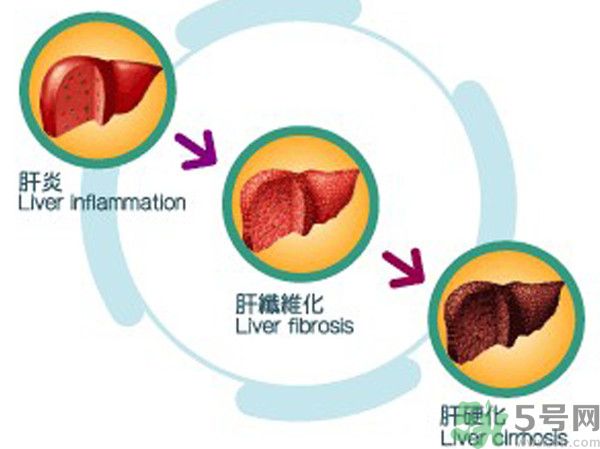 在外面吃飯會(huì)得乙肝嗎？在食堂吃飯會(huì)得乙肝嗎？