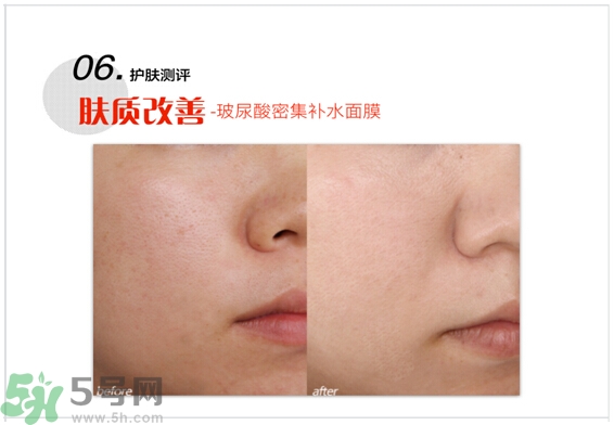 home facialpro玻尿酸密集補(bǔ)水面膜怎么樣與使用方法