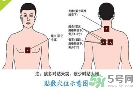 三伏貼能治頸椎病嗎？頸椎病三伏貼穴位