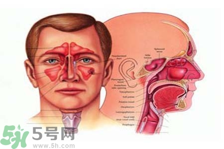 鼻竇炎是什么？鼻竇炎的癥狀有哪些？