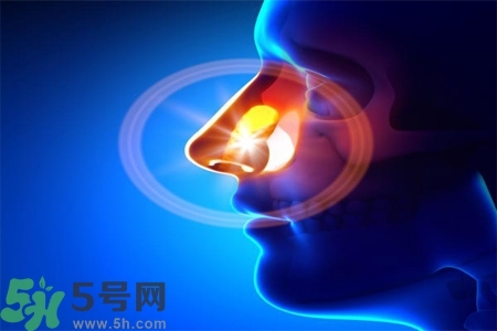 鼻竇炎的高發(fā)人群？如何預(yù)防鼻竇炎？