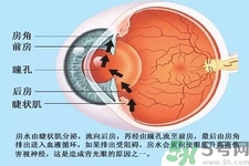 青光眼是什么？青光眼癥狀有什么？