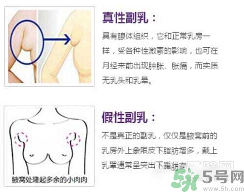 副乳是什么？副乳的危害