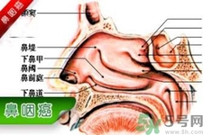 鼻咽癌的發(fā)病因素是什么？鼻咽癌的并發(fā)癥有哪些？