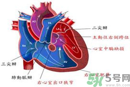 先天性心臟病發(fā)病原因是什么？