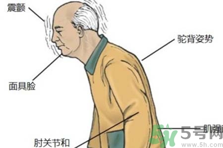 帕金森的易發(fā)人群有哪些？如何預(yù)防帕金森？