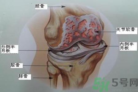 預(yù)防骨病需要注意哪些姿勢？秋季預(yù)防骨病的方法有哪些？