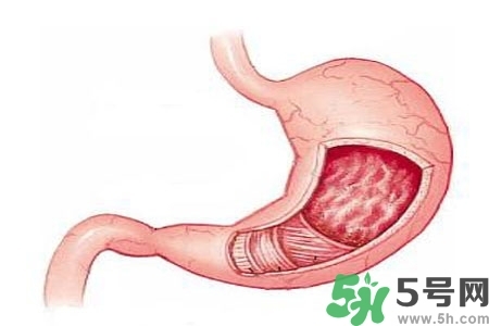 急性腸胃炎哪些食物不可以吃？急性腸胃炎不能吃的水果有？