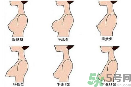 ?女性乳房下垂的原因是什么？女性乳房下垂的分類有哪些？