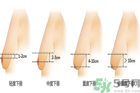 胸部松弛的原因是什么？胸部松弛該怎么辦？