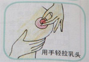 乳頭內(nèi)陷怎么回事？乳頭內(nèi)陷的原因是什么？