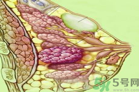 乳房屋硬塊有疼痛感怎么回事？乳房屋硬塊有疼痛感怎么辦？