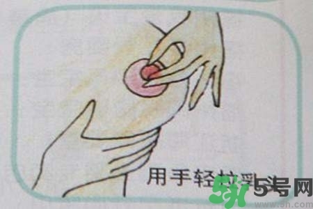 乳頭內(nèi)陷怎么矯正？乳頭內(nèi)陷矯正方法是什么？