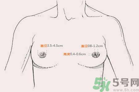 乳頭內(nèi)陷能不能喂奶？乳頭凹陷怎樣哺乳？