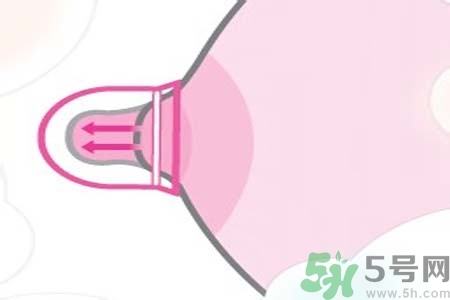 乳頭內(nèi)陷可以用吸奶器嗎？乳頭內(nèi)陷能不能用吸奶器？