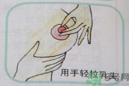 乳頭內(nèi)陷可以拔罐嗎？乳頭內(nèi)陷需要手術(shù)治療嗎？