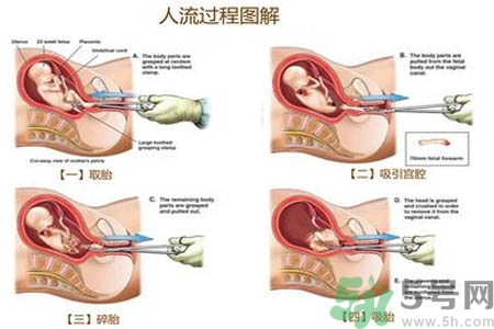 人流后怎么調(diào)養(yǎng)身體？人流后飲食需注意什么？