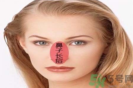 鼻翼長(zhǎng)痘痘怎么回事？鼻翼長(zhǎng)痘痘的原因是什么？