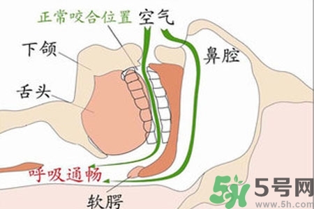 鼻子紅是什么原因？鼻子紅怎么辦？