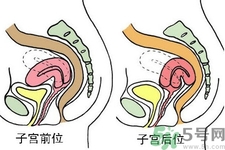 ?子宮移位怎么治療？子宮移位能懷孕嗎？