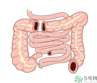 腸炎肚子疼怎么辦？腸炎肚子疼怎么緩解？