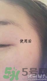 dr.jart適合什么年齡層？蒂佳婷適合年齡