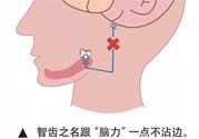 長智齒疼痛怎么辦？長智齒牙齦腫了怎么辦？