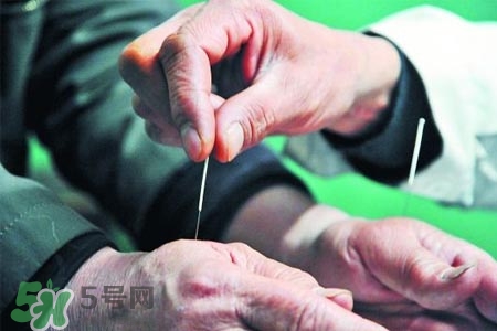 沒病可以針灸嗎？沒病可以扎針嗎？