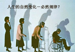 哪些人容易得骨質(zhì)疏松癥？骨質(zhì)疏松的高發(fā)人群有哪些？