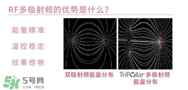 tripollar stop怎么樣？tripollar pose好用嗎