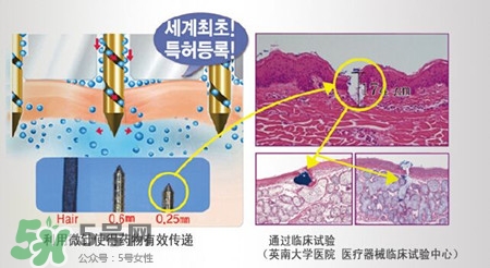 珠兒麗蚊子針好用嗎？珠兒麗蚊子針副作用