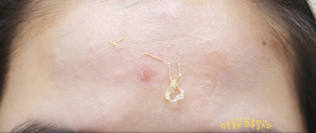 real skin patch怎么樣？real skin是什么牌子