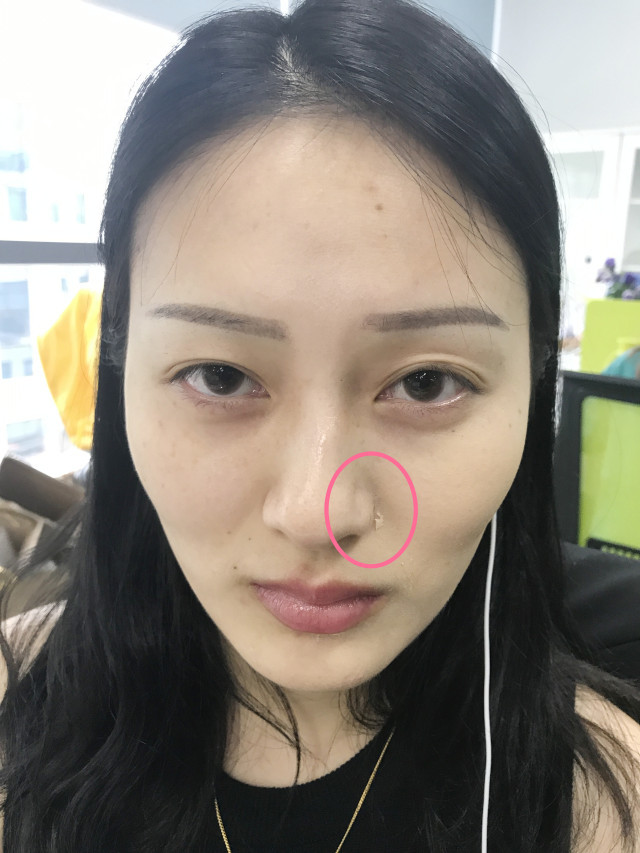 real skin patch怎么樣？real skin是什么牌子