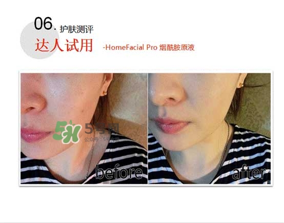 homefacialpro煙酰胺原液怎么樣？hfp煙酰胺原液好用嗎