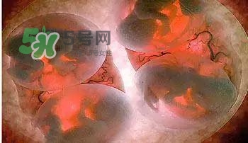 多胞胎是怎么生產(chǎn)的？多胞胎應(yīng)選擇什么分娩方式