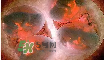 多胞胎順產(chǎn)怎么生？多胞胎剖腹產(chǎn)和單胎剖腹產(chǎn)的區(qū)別