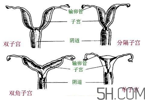 子宮畸形有哪些？子宮畸形有什么影響？