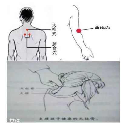 吮痧有什么療效？最溫柔的治病方法