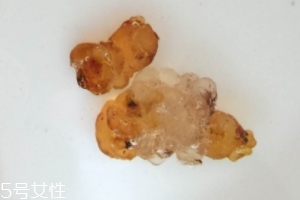 桃膠可以用開水泡嗎？用開水泡桃膠好嗎？