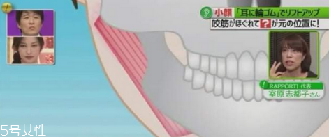 橡皮筋綁耳朵每天用嗎 橡皮筋綁耳朵瘦臉法操作方法