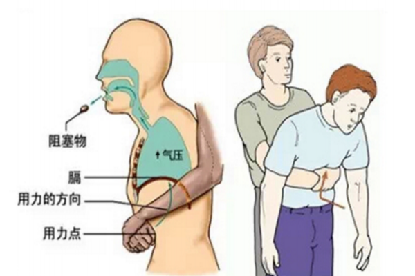 寶寶把口香糖吞下去了怎么辦 寶寶噎著急救方法