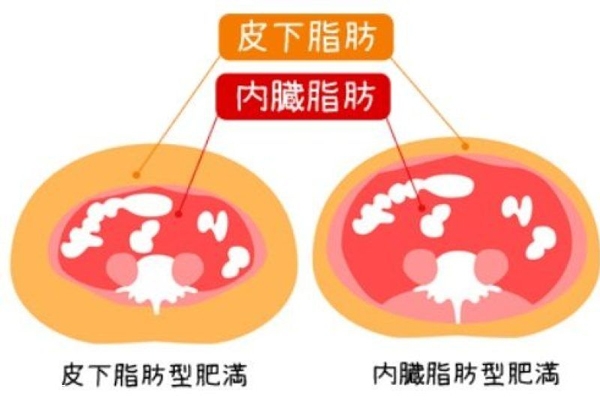 內臟脂肪和皮下脂肪的區(qū)別 內臟脂肪怎么減肥