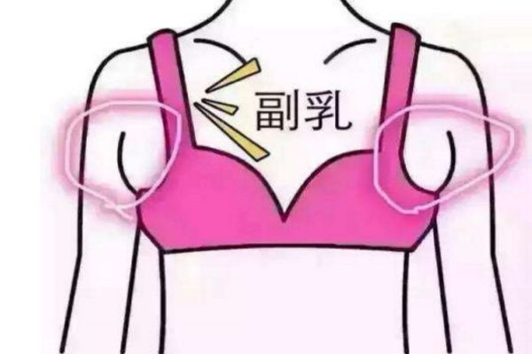 如何去副乳的方法 減掉副乳的最快方法