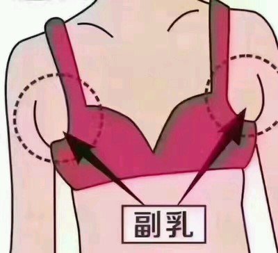 什么是副乳 怎么判斷自己有沒有副乳