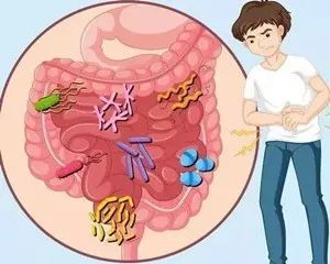 輕度結(jié)腸炎可以不治療嗎 輕度結(jié)腸炎需要治療嗎