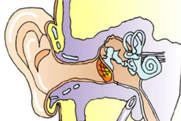 中耳炎怎么治療 中耳炎能根治嗎